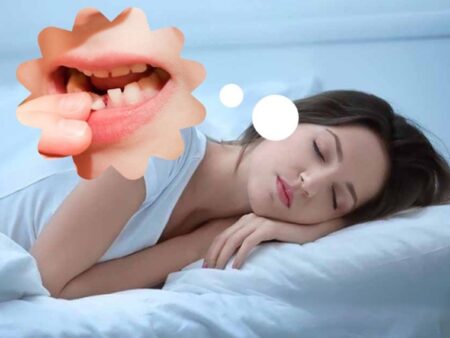 Mơ gãy răng đánh lô con gì? Giải mã giấc mơ gãy răng chuẩn