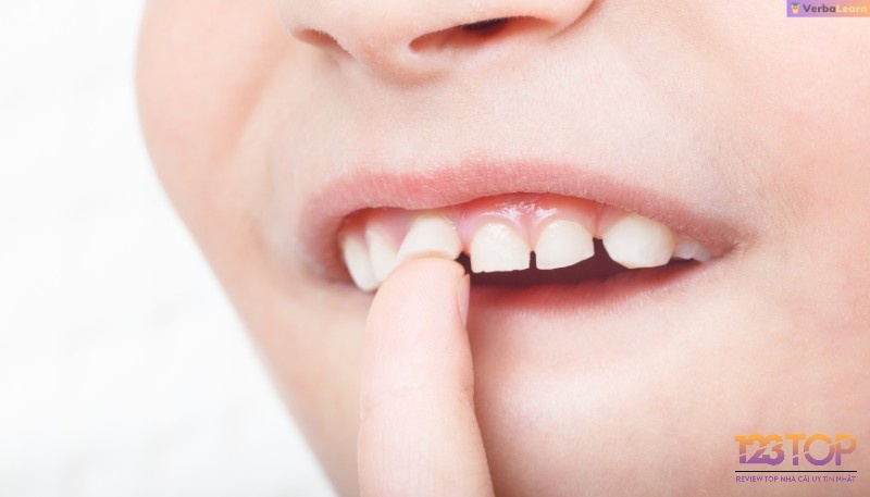 Mơ gãy răng đánh lô con gì? Giấc mơ gãy răng vừa là tín hiệu tâm linh vừa là lời nhắc về những biến chuyển trong cuộc sống thực tế