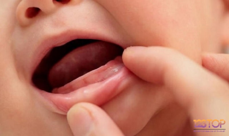 Tình trạng răng và đối tượng mọc răng trong mơ tiết lộ thông điệp riêng, giúp hiểu sâu hơn ý nghĩa giấc mơ.